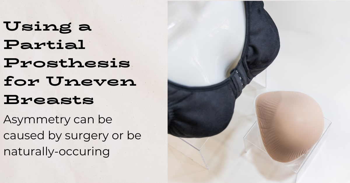 Often Unaware Solution For Uneven Breasts: Lumpectomy prosthesis